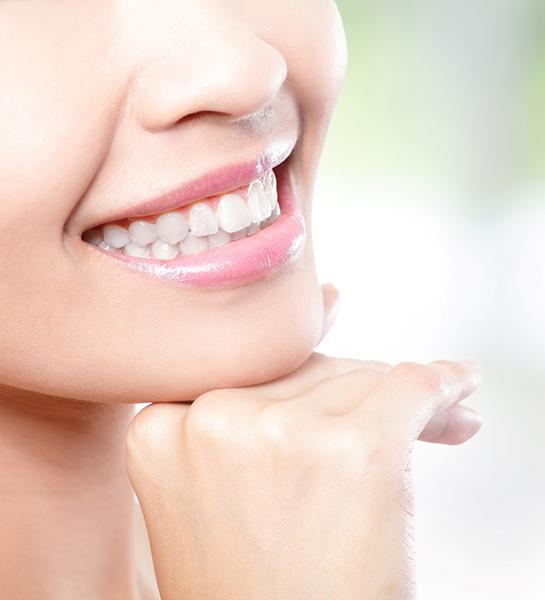 a person smiling after dental bonding in Naples