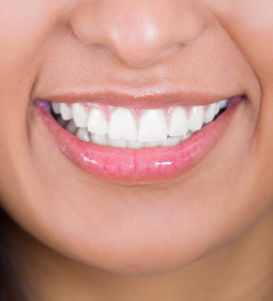 Closeup of dental patient's smile after dental crown restoration