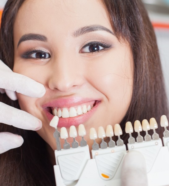 Woman's smile compared with dental restoration color options