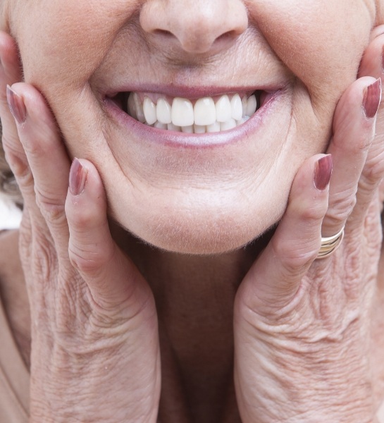 Woman sharing flawless smile after dental implant supported dentures