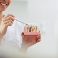 Dentist using smile model to explain the stages of dental implant treatment