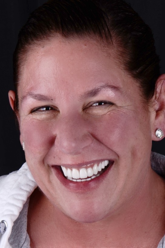 Woman sharing beautiful smile after cosmetic dentistry