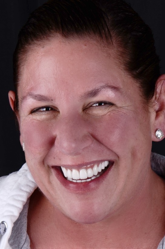 Woman smiling after visiting her cosmetic dentist in Naples