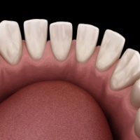 Animated smile with gaps between teeth