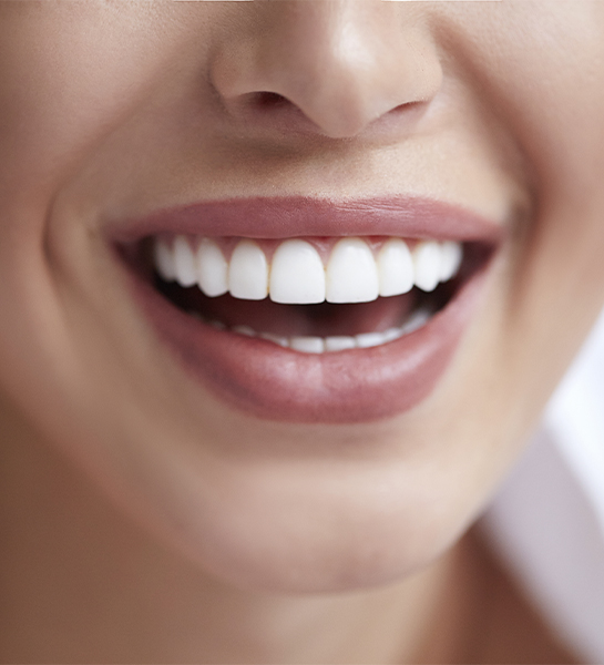 Closeup of smile after teeth whitening