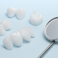 Porcelain veneers compared to other dental restoration options