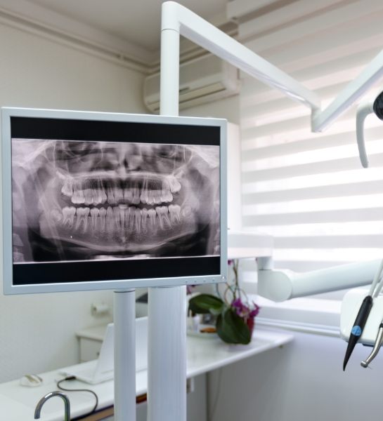 Panoramic dental x-rays images