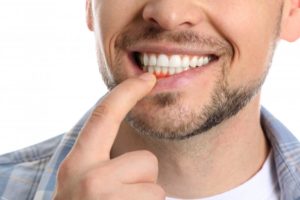 man notices bump on gums