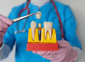 a dentist holding a dental implant model