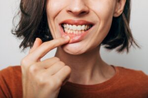 Woman pulling bottom lip down to show gums.