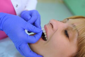 Dentist placing veneers on patient’s front teeth.
